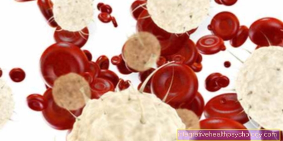 What is Ebola? Symptoms, Zoonotic Origin, and Disease Overview